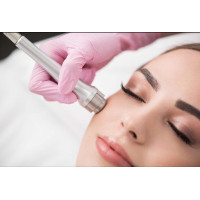 Aлмазна мікродермабразія